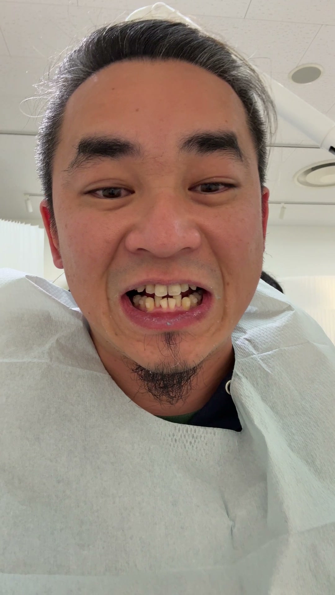 クリニックで口元を見せながら話している本人写真